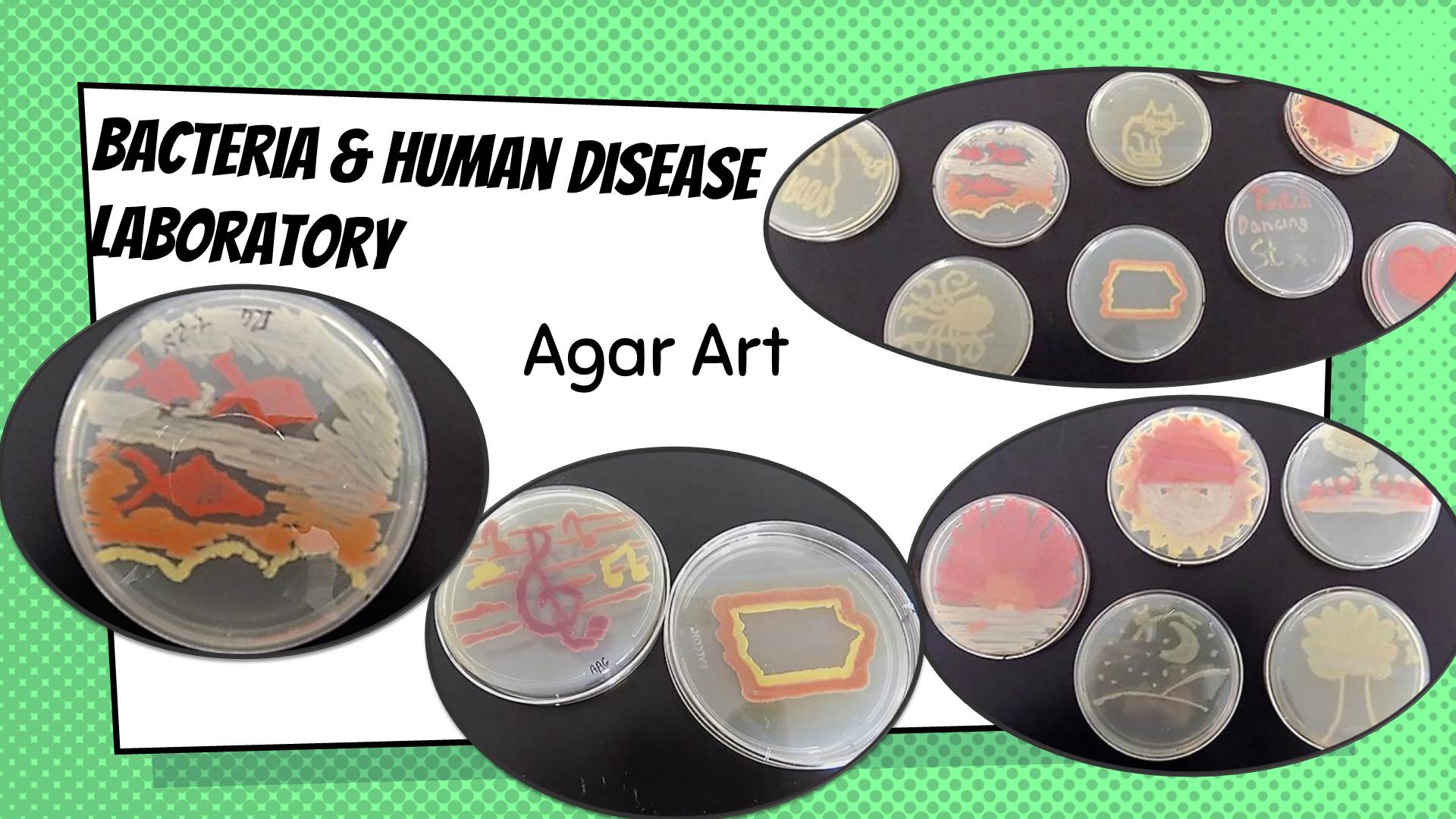 Bacteria And Human Disease lab Agar Art