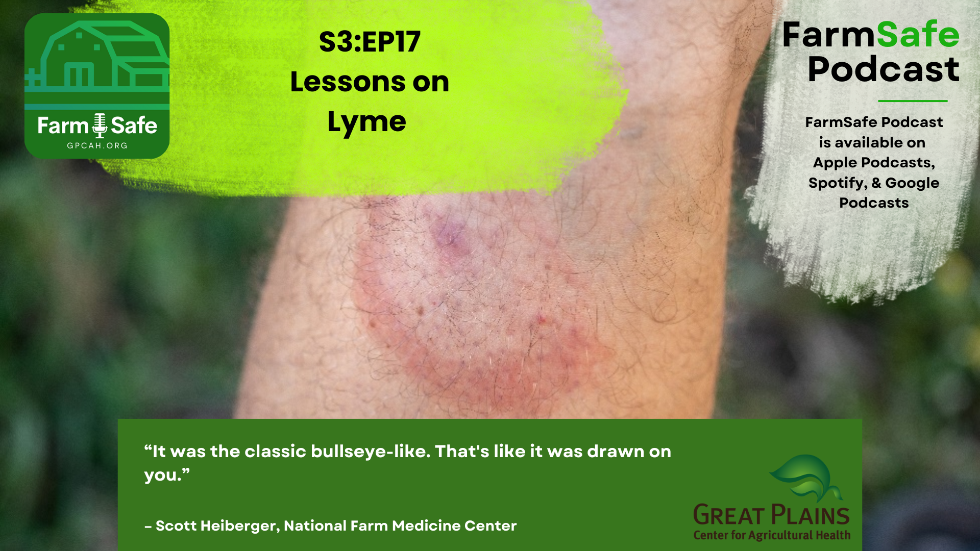 FarmSafe podcast topic - Lessons on Lyme Disease
